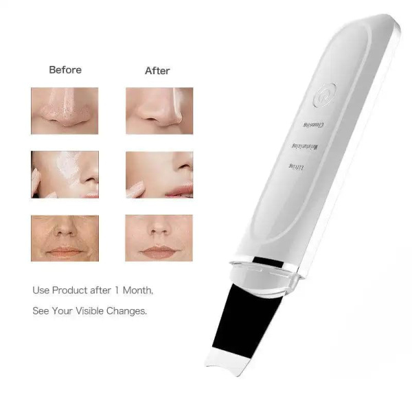 Global Fashion Ultrasonic Skin Cleaner – Deep Cleansing | C-103 Ultrasonic Skin Cleaner Facial Scrubber | جهاز تنظيف البشرة
Global Fashion Ultrasonic Skin Cleaner – Deep Cleansing | C-103 Blackhead Remover Device Deep Cleansing | جهاز ازالة الرؤوس السوداء