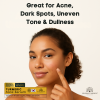 Turmeric Anti-Acne Face Serum 50ml Serum Close Up - Hydrating Anti Aging Facial Treatment | سيروم للوجه صورة مقربة